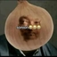 SON
